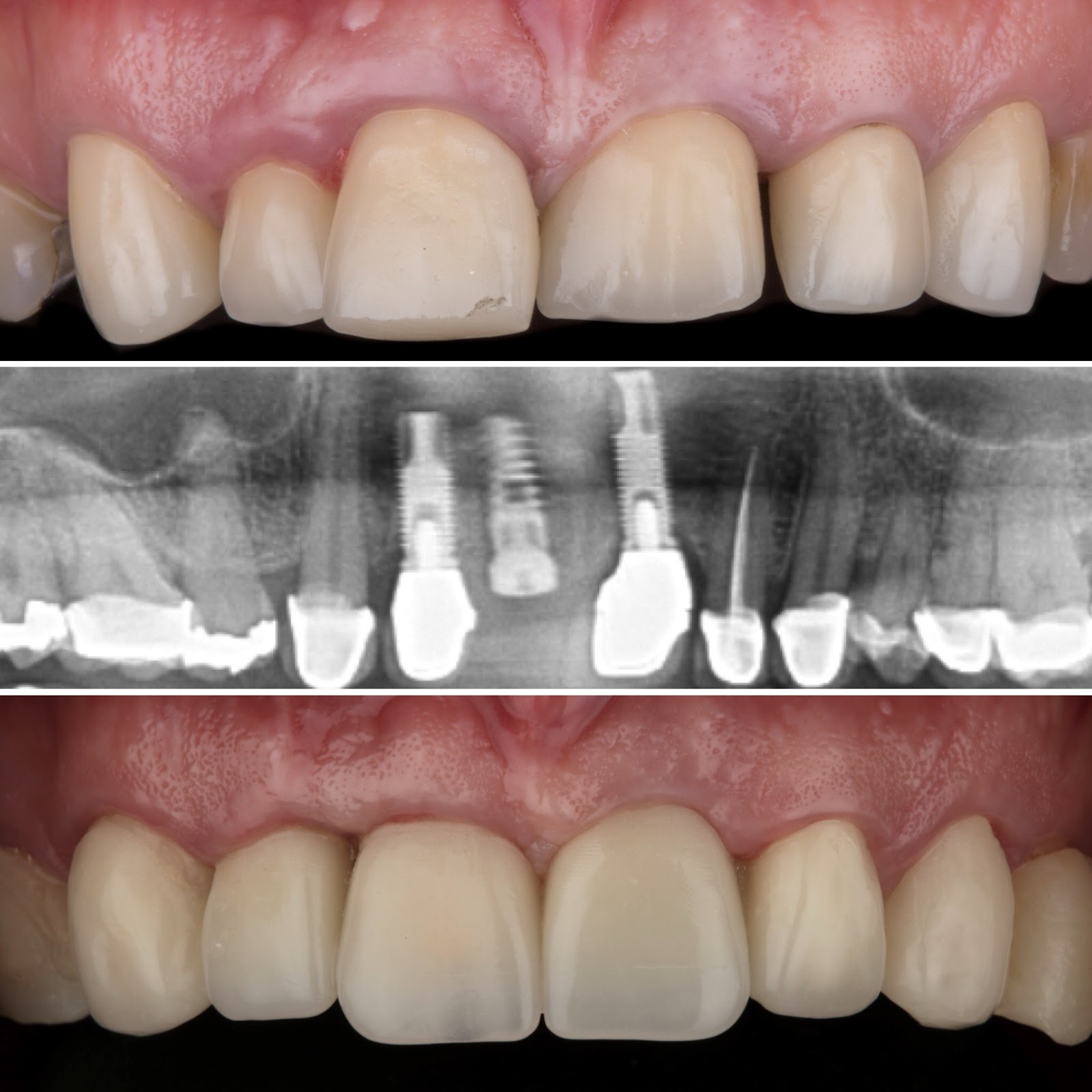 leetx-google-photo-1004-2