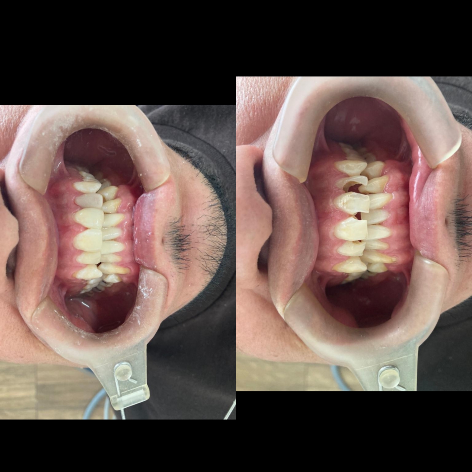 leetx-google-photo-1013-2