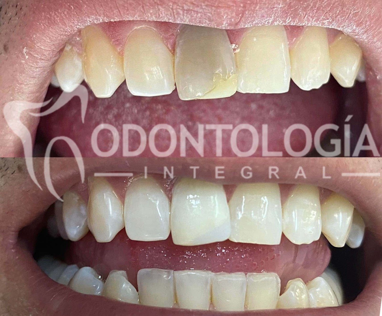 leetx-google-photo-1024-2