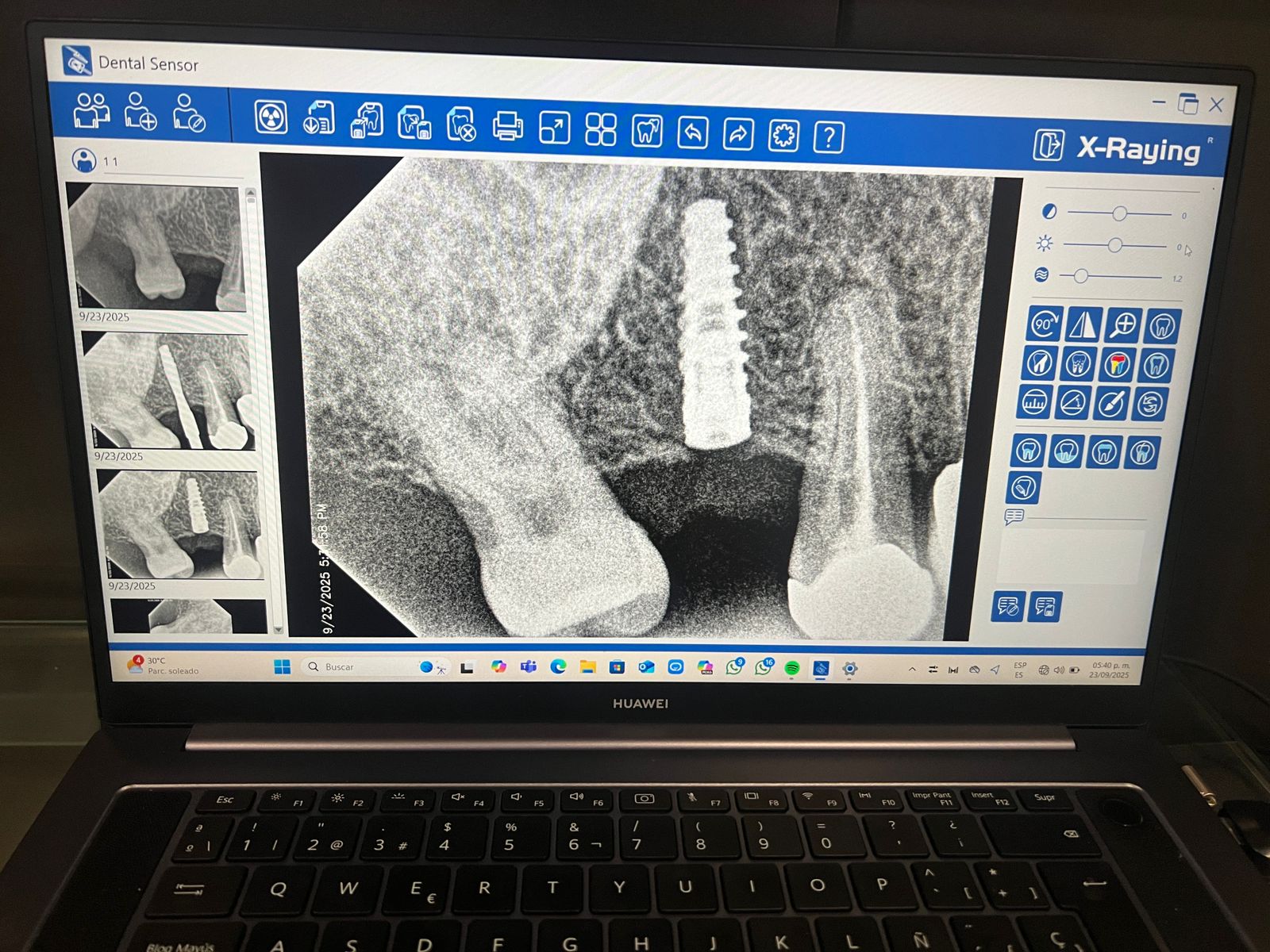 leetx-google-photo-996-2