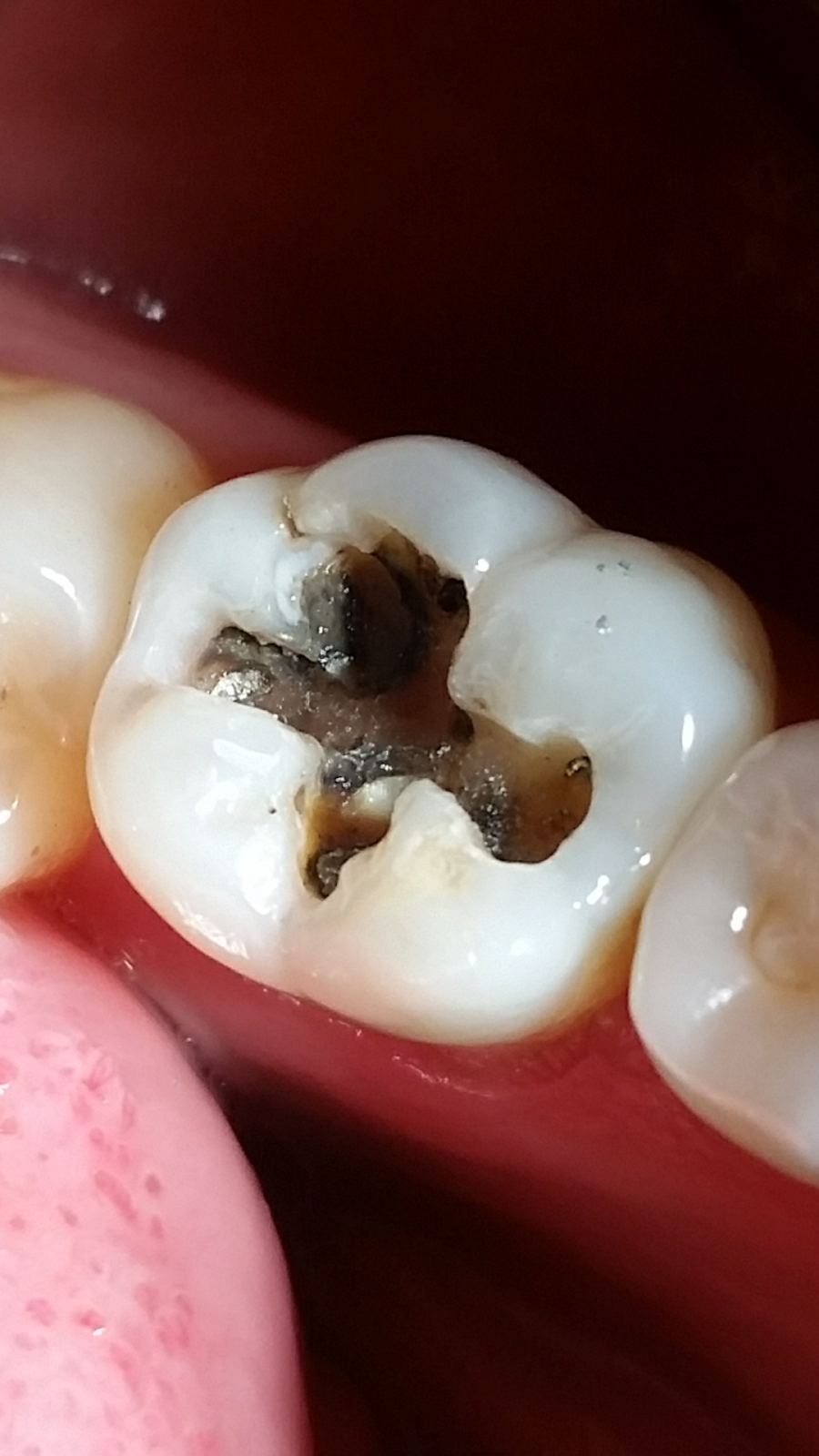 leetx-google-photo-1046-2